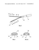 Devices and Systems for Carotid Body Ablation diagram and image