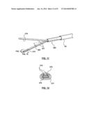 Devices and Systems for Carotid Body Ablation diagram and image