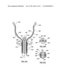 Devices and Systems for Carotid Body Ablation diagram and image