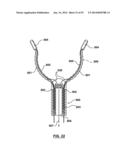 Devices and Systems for Carotid Body Ablation diagram and image