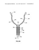 Devices and Systems for Carotid Body Ablation diagram and image