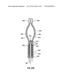 Devices and Systems for Carotid Body Ablation diagram and image