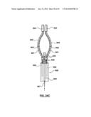 Devices and Systems for Carotid Body Ablation diagram and image