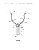 Devices and Systems for Carotid Body Ablation diagram and image