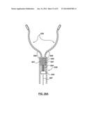 Devices and Systems for Carotid Body Ablation diagram and image