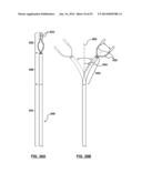 Devices and Systems for Carotid Body Ablation diagram and image