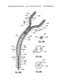 Devices and Systems for Carotid Body Ablation diagram and image