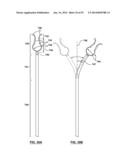 Devices and Systems for Carotid Body Ablation diagram and image