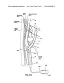 Devices and Systems for Carotid Body Ablation diagram and image