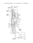 Devices and Systems for Carotid Body Ablation diagram and image