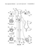 Devices and Systems for Carotid Body Ablation diagram and image