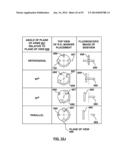 Devices and Systems for Carotid Body Ablation diagram and image