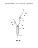 Devices and Systems for Carotid Body Ablation diagram and image