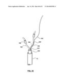 Devices and Systems for Carotid Body Ablation diagram and image