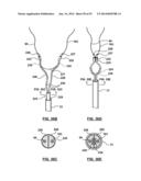 Devices and Systems for Carotid Body Ablation diagram and image