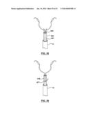 Devices and Systems for Carotid Body Ablation diagram and image