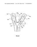 Devices and Systems for Carotid Body Ablation diagram and image