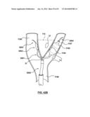 Devices and Systems for Carotid Body Ablation diagram and image