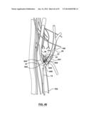 Devices and Systems for Carotid Body Ablation diagram and image