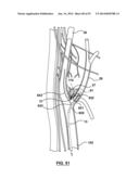 Devices and Systems for Carotid Body Ablation diagram and image