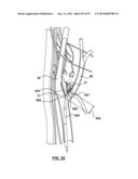 Devices and Systems for Carotid Body Ablation diagram and image