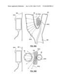 Devices and Systems for Carotid Body Ablation diagram and image