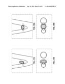 Devices and Systems for Carotid Body Ablation diagram and image