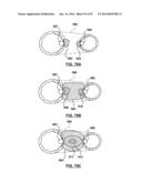 Devices and Systems for Carotid Body Ablation diagram and image