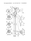 Devices and Systems for Carotid Body Ablation diagram and image