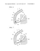 MEDICAL INSTRUMENT FOR ENDOSCOPE AND TREATMENT METHOD diagram and image