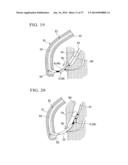 MEDICAL INSTRUMENT FOR ENDOSCOPE AND TREATMENT METHOD diagram and image