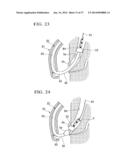 MEDICAL INSTRUMENT FOR ENDOSCOPE AND TREATMENT METHOD diagram and image