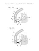 MEDICAL INSTRUMENT FOR ENDOSCOPE AND TREATMENT METHOD diagram and image