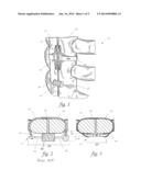 DYNAMIC TISSUE HOLDING DEVICE WITH LOW PROFILE SPRING diagram and image