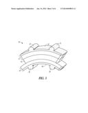 CEMENTING OF AN ORTHOPEDIC IMPLANT diagram and image