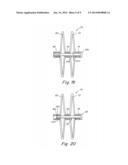 Screw Catch Mechanism for PFO Occluder and Method of Use diagram and image