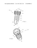 VARIABLE ANGLE BONE FIXATION DEVICE diagram and image