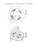 VARIABLE ANGLE BONE FIXATION DEVICE diagram and image