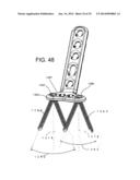 VARIABLE ANGLE BONE FIXATION DEVICE diagram and image