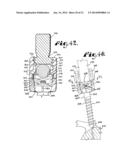 POLYAXIAL BONE SCREW WITH SHANK ARTICULATION PRESSURE INSERT AND METHOD diagram and image