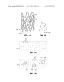 POLYMER-BIOCERAMIC COMPOSITE IMPLANTABLE MEDICAL DEVICE WITH DIFFERENT     TYPES OF BIOCERAMIC PARTICLES diagram and image