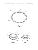 METHODS FOR CONTROLLING THE INTERNAL CIRCUMFERENCE OF AN ANATOMIC ORIFICE     OR LUMEN diagram and image