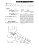 ATTACHMENTS FOR ORTHOPEDIC IMPLANTS diagram and image