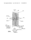 METHOD AND SYSTEM OF MAPPING FEMORAL HEAD FOR ACETABULAR PROSTHESIS     ALIGNMENT diagram and image