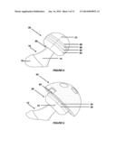 METHOD AND SYSTEM OF MAPPING FEMORAL HEAD FOR ACETABULAR PROSTHESIS     ALIGNMENT diagram and image