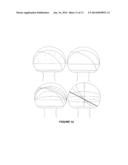 METHOD AND SYSTEM OF MAPPING FEMORAL HEAD FOR ACETABULAR PROSTHESIS     ALIGNMENT diagram and image