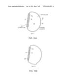 VARIABLE DENSITY TISSUE GRAFT COMPOSITION AND METHODS OF MAKING AND USING     THE SAME diagram and image