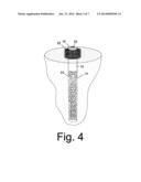 WATERING SYSTEM AND METHOD OF IMPLEMENTING diagram and image