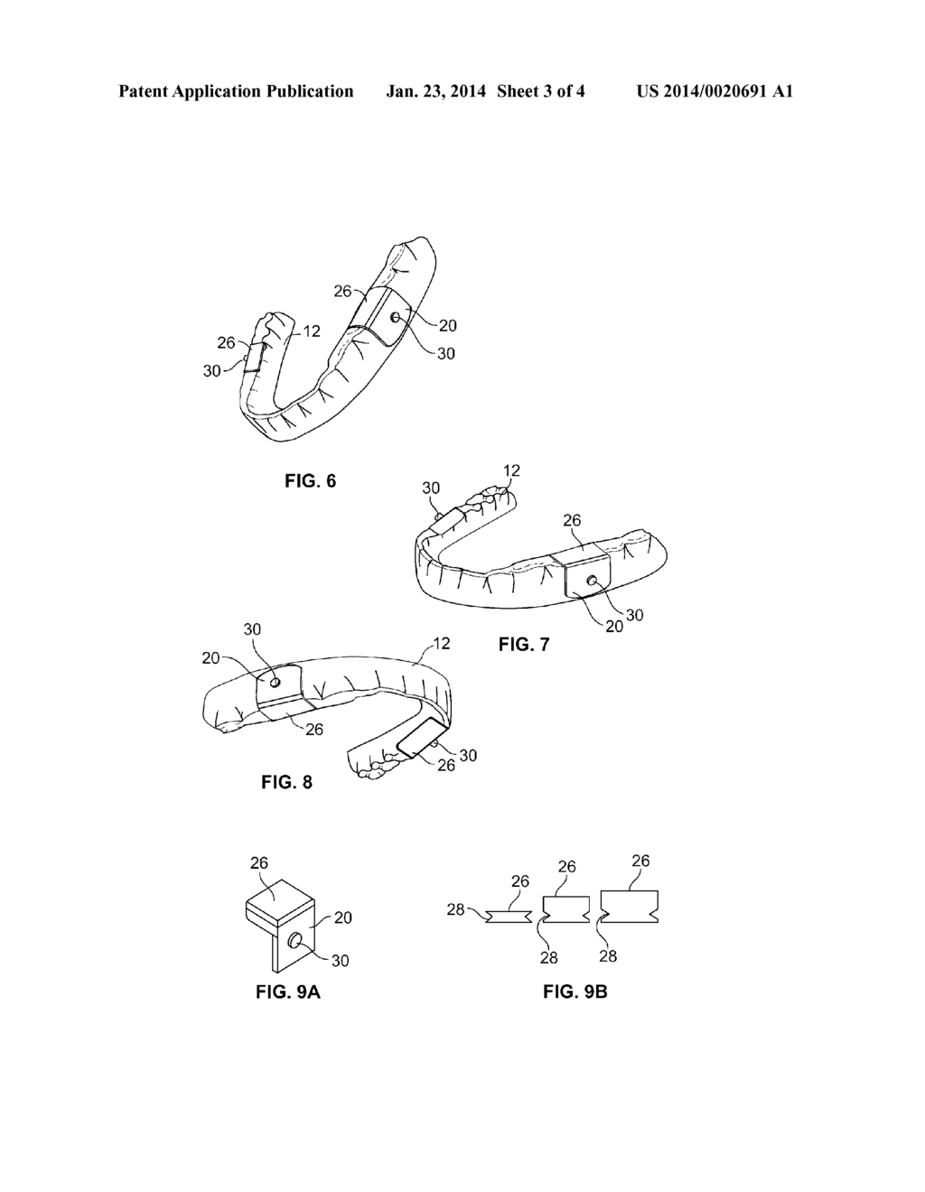 ORAL APPLIANCE FOR TREATMENT OF MEDICAL CONDITIONS SUCH AS OBSTRUCTIVE     SLEEP APNEA AND SNORING AND FOR IMPROVING ATHLETIC PERFORMANCE AND METHOD     OF OPTIMIZING SAME - diagram, schematic, and image 04