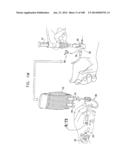 SAFETY DRUG HANDLING DEVICE diagram and image